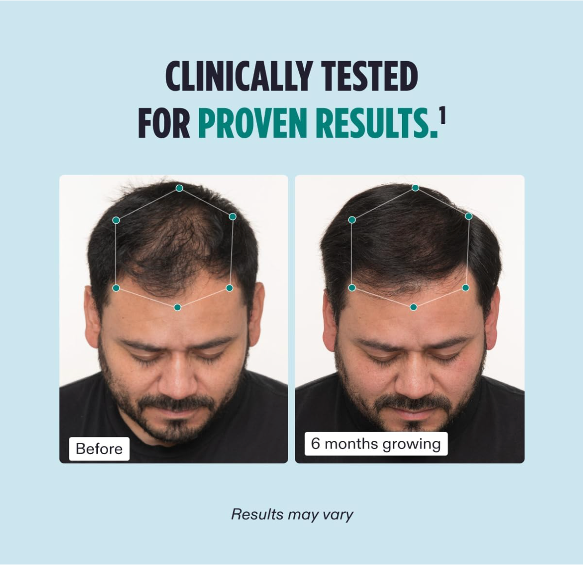 Nutrafol Men: Hair Growth Nutraceutical