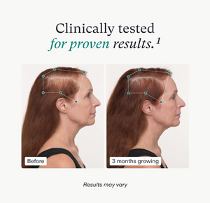 Nutrafol Women's Balance: Hair Growth Nutraceutical